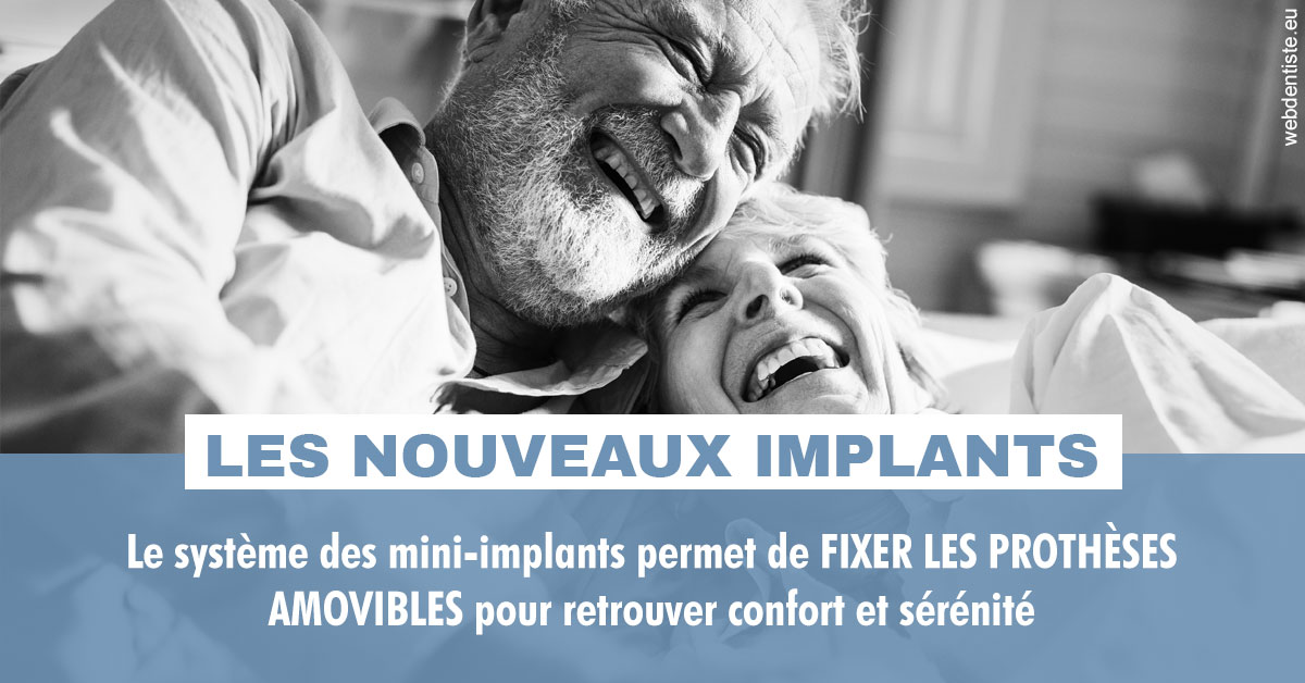 https://dr-sanglard-gilles.chirurgiens-dentistes.fr/Les nouveaux implants 2