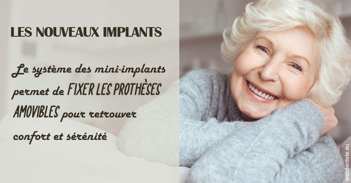 https://dr-sanglard-gilles.chirurgiens-dentistes.fr/Les nouveaux implants 1