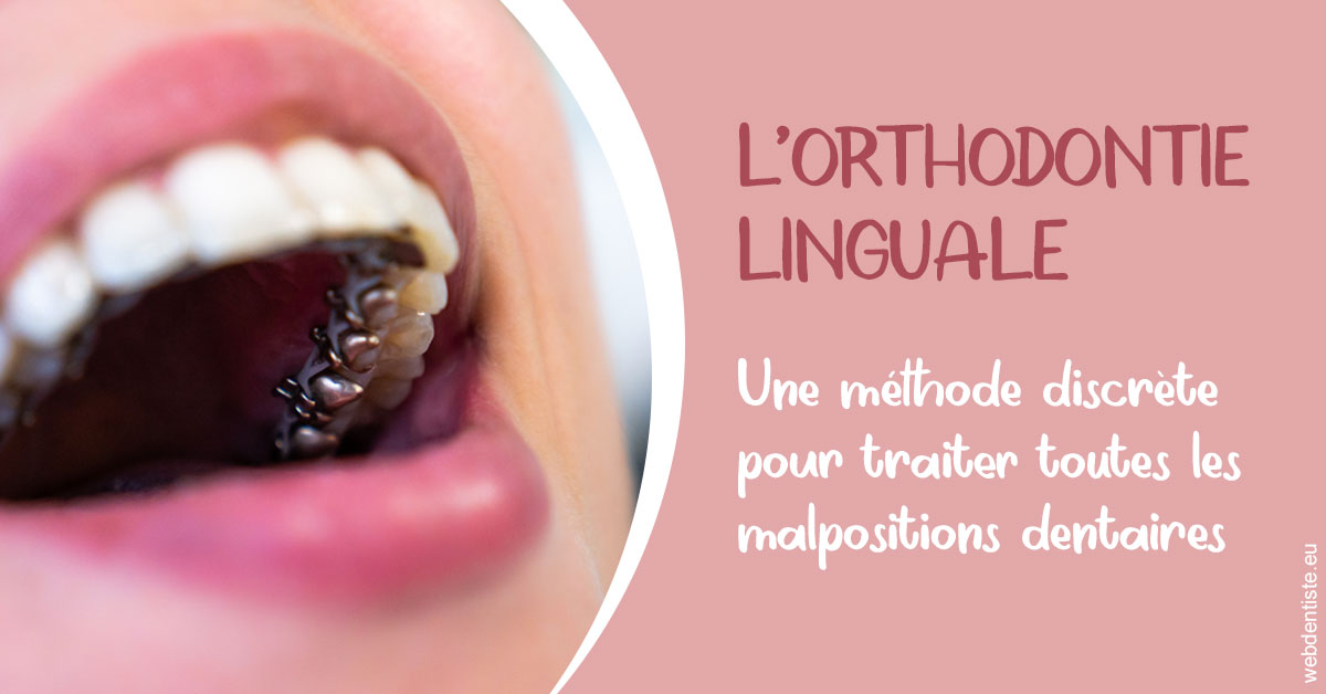 https://dr-sanglard-gilles.chirurgiens-dentistes.fr/L'orthodontie linguale 2