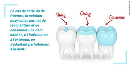 https://dr-sanglard-gilles.chirurgiens-dentistes.fr/L'INLAY ou l'ONLAY