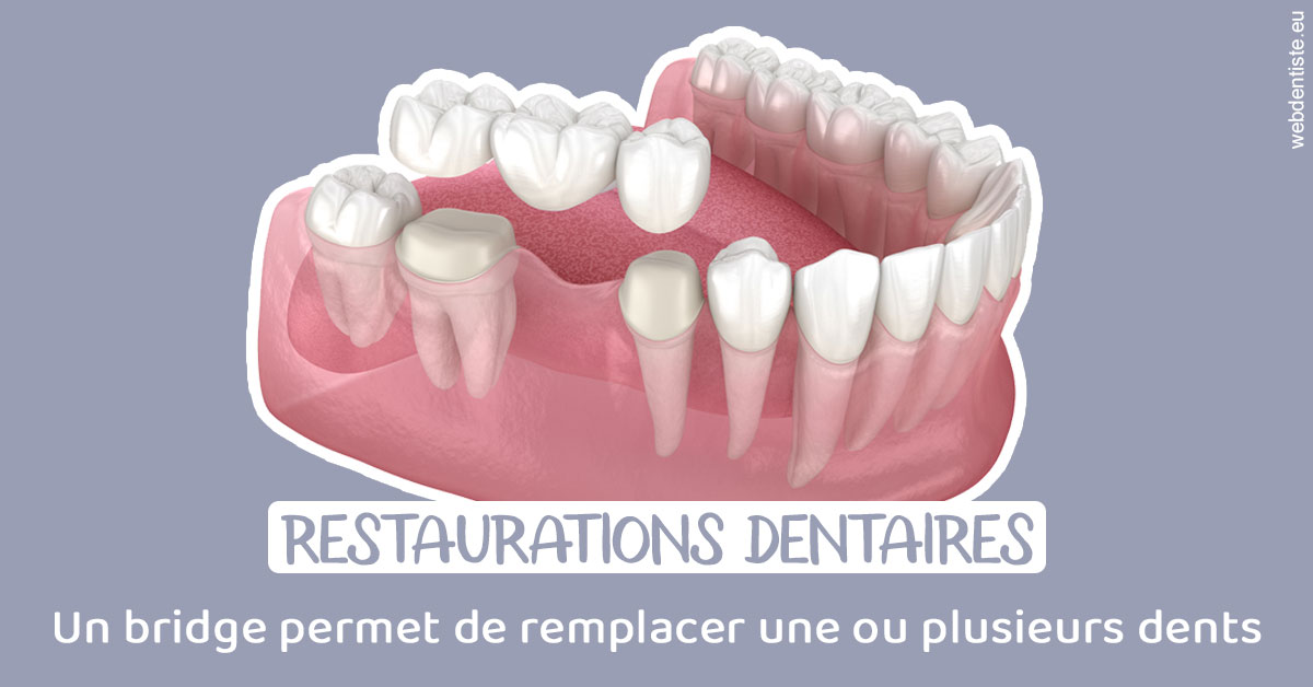 https://dr-sanglard-gilles.chirurgiens-dentistes.fr/Bridge remplacer dents 1