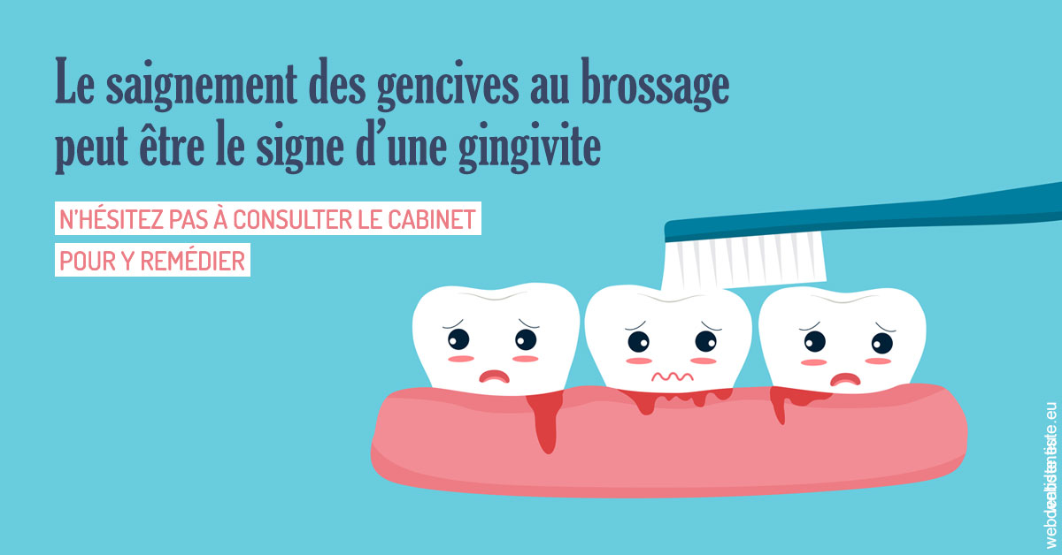 https://dr-sanglard-gilles.chirurgiens-dentistes.fr/Saignement gencives 2