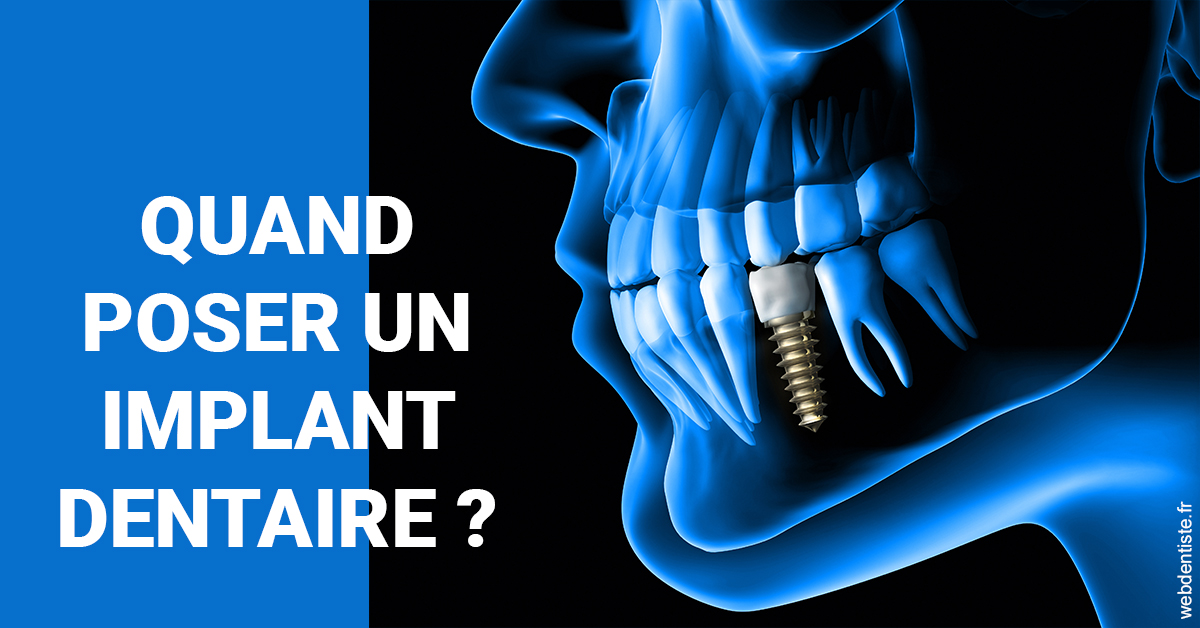 https://dr-sanglard-gilles.chirurgiens-dentistes.fr/Les implants 1