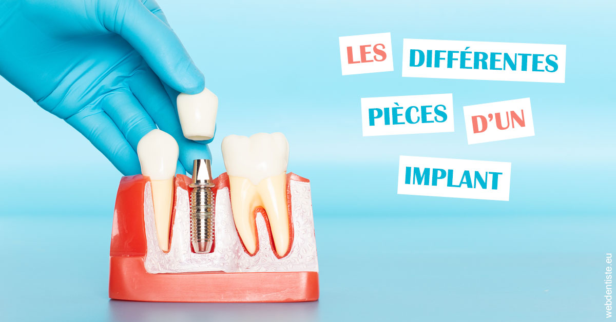 https://dr-sanglard-gilles.chirurgiens-dentistes.fr/Les différentes pièces d’un implant 2
