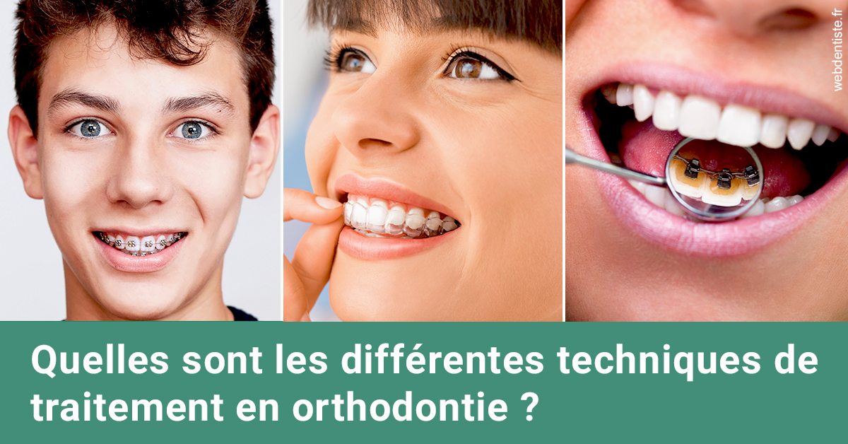 https://dr-sanglard-gilles.chirurgiens-dentistes.fr/Les différentes techniques de traitement 2