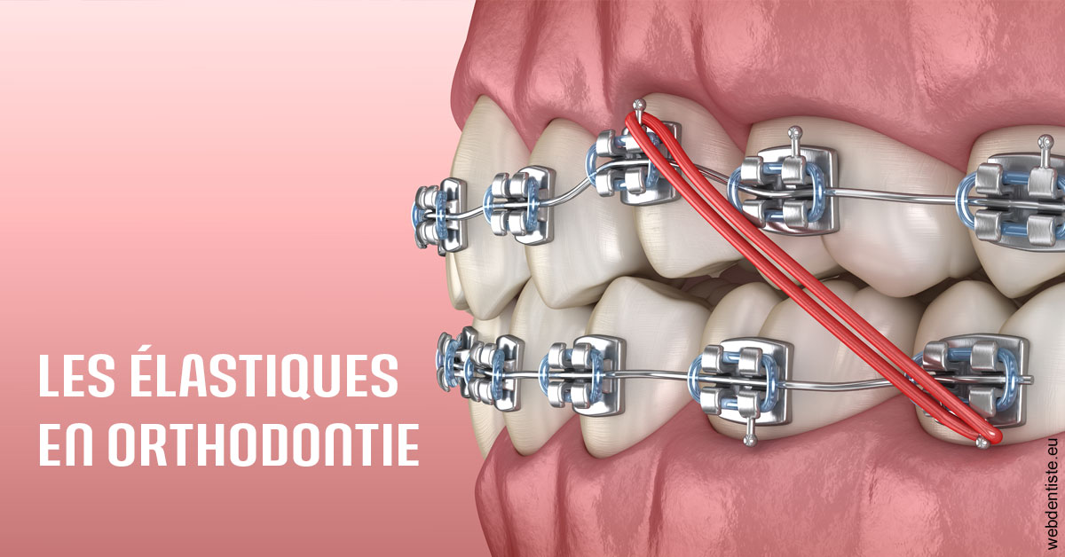 https://dr-sanglard-gilles.chirurgiens-dentistes.fr/Elastiques orthodontie 2