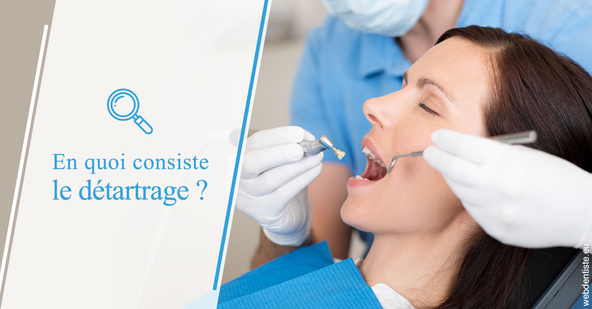 https://dr-sanglard-gilles.chirurgiens-dentistes.fr/En quoi consiste le détartrage