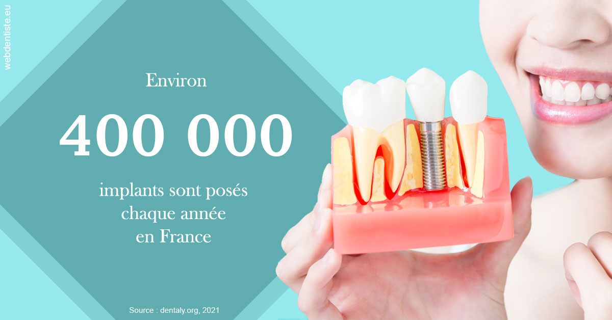 https://dr-sanglard-gilles.chirurgiens-dentistes.fr/Pose d'implants en France 2